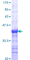 STAC Protein - 12.5% SDS-PAGE Stained with Coomassie Blue.