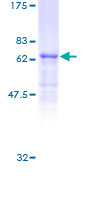 STAC3 Protein - 12.5% SDS-PAGE of human STAC3 stained with Coomassie Blue