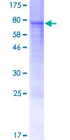 STAF50 / TRIM22 Protein - 12.5% SDS-PAGE of human TRIM22 stained with Coomassie Blue