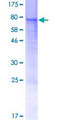 STAF50 / TRIM22 Protein - 12.5% SDS-PAGE of human TRIM22 stained with Coomassie Blue