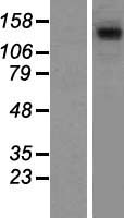 STAG1 / SA1 Protein - Western validation with an anti-DDK antibody * L: Control HEK293 lysate R: Over-expression lysate