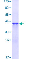 STAG2 Protein - 12.5% SDS-PAGE Stained with Coomassie Blue.