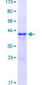 STAG2 Protein - 12.5% SDS-PAGE Stained with Coomassie Blue.