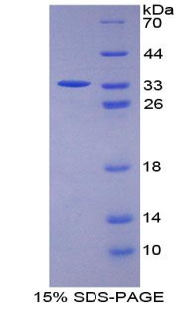 STAM1 / STAM Protein - Recombinant Signal Transducing Adaptor Molecule 1 By SDS-PAGE