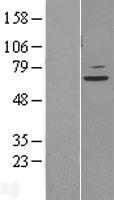 STAM2 Protein - Western validation with an anti-DDK antibody * L: Control HEK293 lysate R: Over-expression lysate