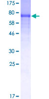 STAM2 Protein - 12.5% SDS-PAGE of human STAM2 stained with Coomassie Blue