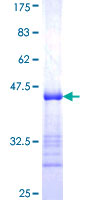 STAM2 Protein - 12.5% SDS-PAGE Stained with Coomassie Blue.