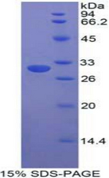 STAMBP / AMSH Protein - Recombinant STAM Binding Protein By SDS-PAGE