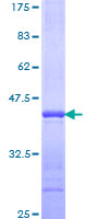 STAP1 / BRDG1 Protein - 12.5% SDS-PAGE Stained with Coomassie Blue.