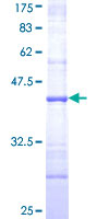 STAP2 Protein - 12.5% SDS-PAGE Stained with Coomassie Blue.