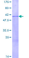 STAR Protein - 12.5% SDS-PAGE of human STAR stained with Coomassie Blue