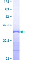 STAR Protein - 12.5% SDS-PAGE Stained with Coomassie Blue.