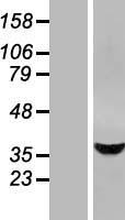 STARD10 Protein - Western validation with an anti-DDK antibody * L: Control HEK293 lysate R: Over-expression lysate