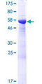 STARD10 Protein - 12.5% SDS-PAGE of human STARD10 stained with Coomassie Blue