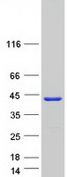 STARD10 Protein - Purified recombinant protein STARD10 was analyzed by SDS-PAGE gel and Coomassie Blue Staining
