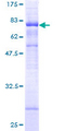 STARD3 / MLN64 Protein - 12.5% SDS-PAGE of human STARD3 stained with Coomassie Blue