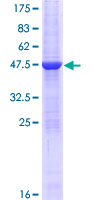 STARD4 Protein - 12.5% SDS-PAGE of human STARD4 stained with Coomassie Blue
