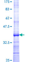STARD5 Protein - 12.5% SDS-PAGE Stained with Coomassie Blue.