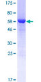 STARD7 Protein - 12.5% SDS-PAGE of human STARD7 stained with Coomassie Blue