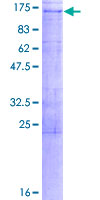STARD8 Protein - 12.5% SDS-PAGE of human STARD8 stained with Coomassie Blue