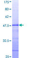 STAT2 Protein - 12.5% SDS-PAGE Stained with Coomassie Blue.