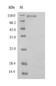 STAT3 Protein - (Tris-Glycine gel) Discontinuous SDS-PAGE (reduced) with 5% enrichment gel and 15% separation gel.