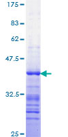 STAT3 Protein - 12.5% SDS-PAGE Stained with Coomassie Blue.