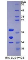 STAT3 Protein - Recombinant Signal Transducer And Activator Of Transcription 3 (STAT3) by SDS-PAGE