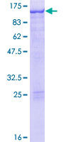 STAT5A Protein - 12.5% SDS-PAGE of human STAT5A stained with Coomassie Blue