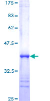 STAT5A Protein - 12.5% SDS-PAGE Stained with Coomassie Blue.