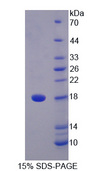 STAT5A Protein - Recombinant  Signal Transducer And Activator Of Transcription 5A By SDS-PAGE