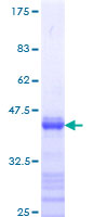STAT5B Protein - 12.5% SDS-PAGE Stained with Coomassie Blue.
