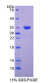 STAT5B Protein - Recombinant  Signal Transducer And Activator Of Transcription 5B By SDS-PAGE