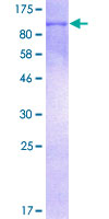 STAT6 Protein - 12.5% SDS-PAGE of human STAT6 stained with Coomassie Blue