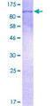 STAT6 Protein - 12.5% SDS-PAGE of human STAT6 stained with Coomassie Blue