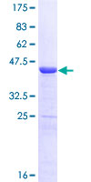 STAT6 Protein - 12.5% SDS-PAGE Stained with Coomassie Blue.