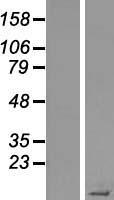 Statherin / STR Protein - Western validation with an anti-DDK antibody * L: Control HEK293 lysate R: Over-expression lysate