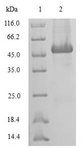 Statherin / STR Protein - (Tris-Glycine gel) Discontinuous SDS-PAGE (reduced) with 5% enrichment gel and 15% separation gel.