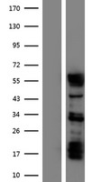 STAU1 / Staufen Protein - Western validation with an anti-DDK antibody * L: Control HEK293 lysate R: Over-expression lysate