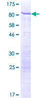 STAU1 / Staufen Protein - 12.5% SDS-PAGE of human STAU1 stained with Coomassie Blue