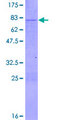 STAU2 Protein - 12.5% SDS-PAGE of human STAU2 stained with Coomassie Blue