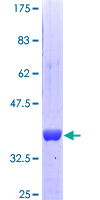 STBD1 Protein - 12.5% SDS-PAGE Stained with Coomassie Blue.