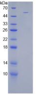 STC1 / Stanniocalcin Protein - Recombinant Stanniocalcin 1 By SDS-PAGE