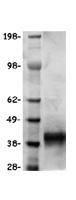 STC2 / Stanniocalcin 2 Protein