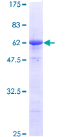 STC2 / Stanniocalcin 2 Protein - 12.5% SDS-PAGE of human STC2 stained with Coomassie Blue