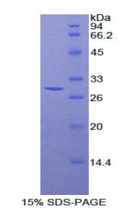 STC2 / Stanniocalcin 2 Protein - Recombinant Stanniocalcin 2 By SDS-PAGE