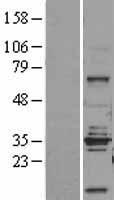 STEAP1 / STEAP Protein - Western validation with an anti-DDK antibody * L: Control HEK293 lysate R: Over-expression lysate