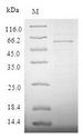 STEAP1 / STEAP Protein - (Tris-Glycine gel) Discontinuous SDS-PAGE (reduced) with 5% enrichment gel and 15% separation gel.