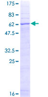 STEAP1 / STEAP Protein - 12.5% SDS-PAGE of human STEAP1 stained with Coomassie Blue