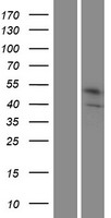 STEAP1B Protein - Western validation with an anti-DDK antibody * L: Control HEK293 lysate R: Over-expression lysate
